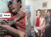 Sigap dan Humanis, Sat Reskrim Polres Simalungun Kawal Terlapor Penganiayaan ke RSJ Medan Dini Hari